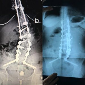 Meet your poshers janky spine 😜